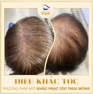 điêu khắc sợi tóc