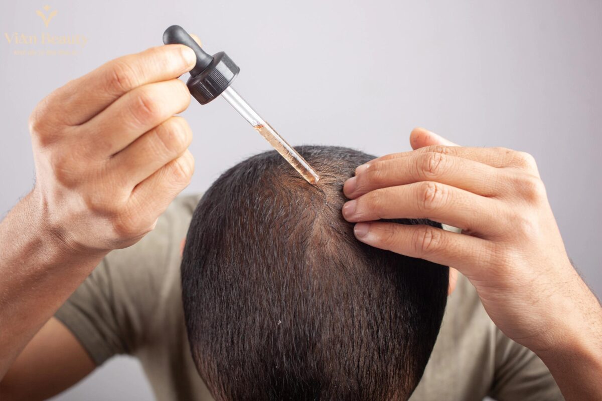 Sai Lầm Khi Trị Hối Đầu