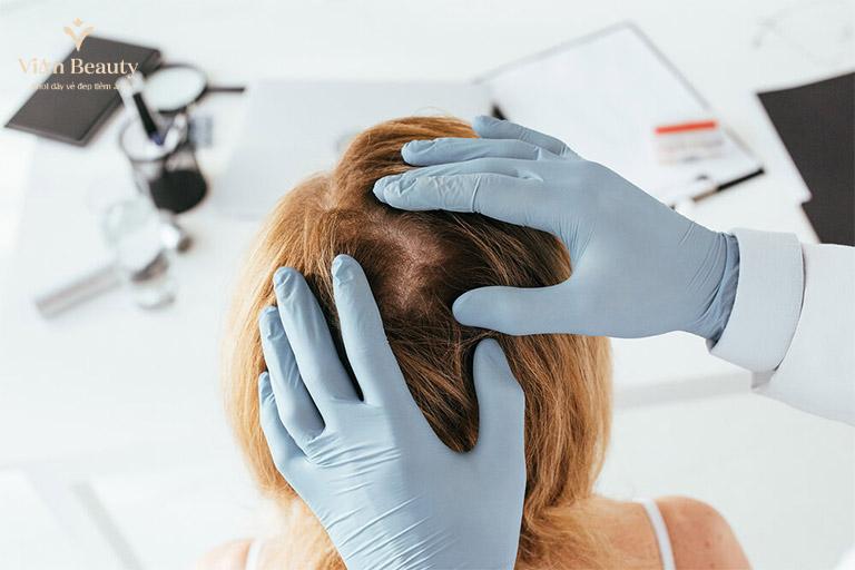 Sai Lầm Khi Trị Hối Đầu