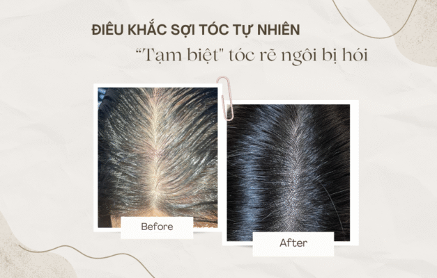 Neutral Aesthetic Skincare Before After Facebook Post 940 X 600 Px