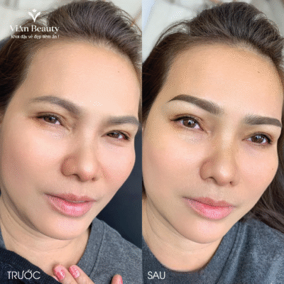 Phay Soi Dau Phun Duoi 02