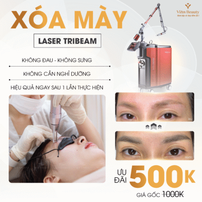 Xoa May Laser 01