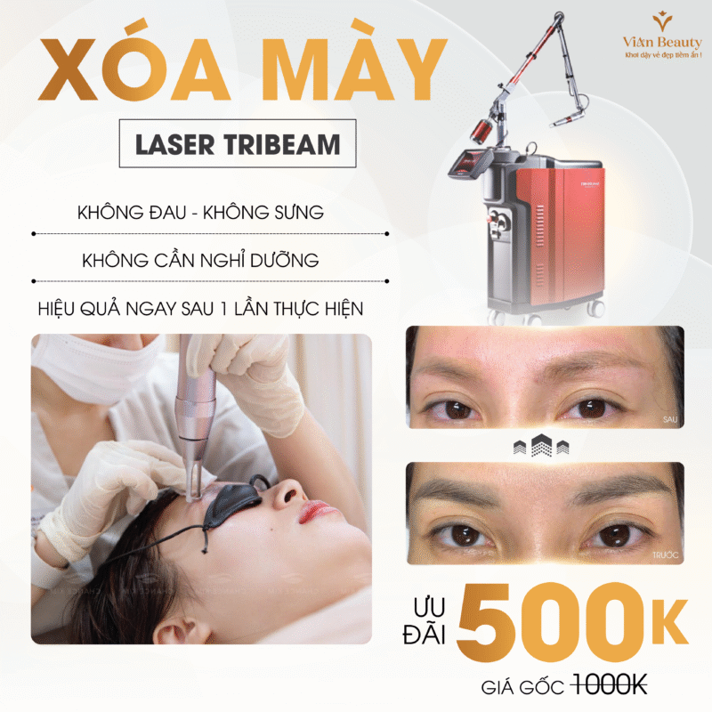 Xoa May Laser 01