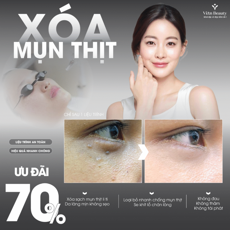 Xoa Mun Thit