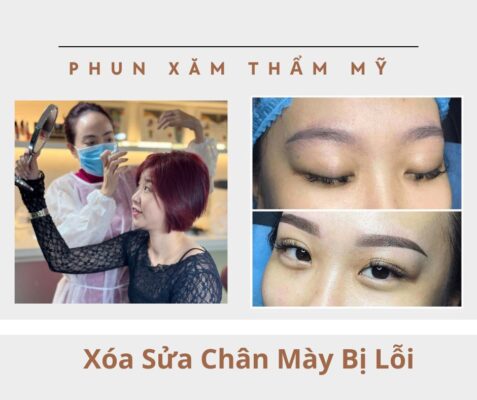 Xóa Sửa Chân Mày Bị Lỗi Tại Vian Beauty