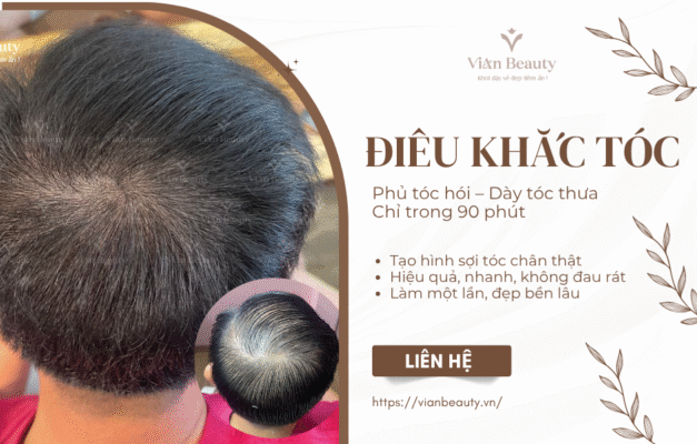 Dieu Khac Soi Toc Dinh Dau