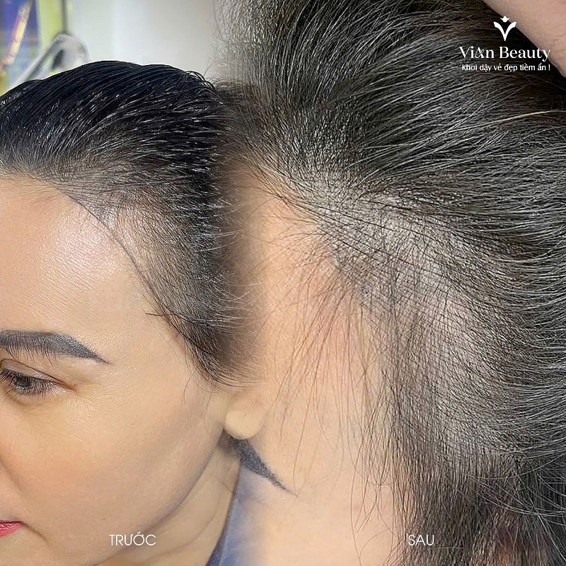 Dieu Khac Toc Re Ngoi Tu Nhien Tai Vianbeauty 4