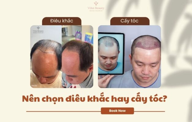 Nen Chon Dieu Khac Toc Hay Cay Toc