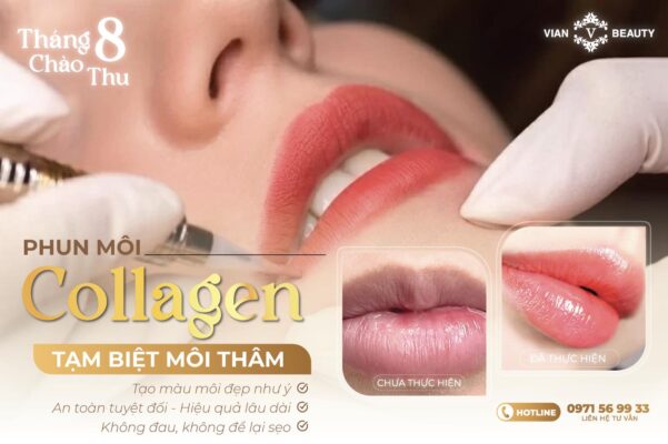 Phun Moi Collagen Len Mau Chuan Tai Vian Beauty Hcm 2