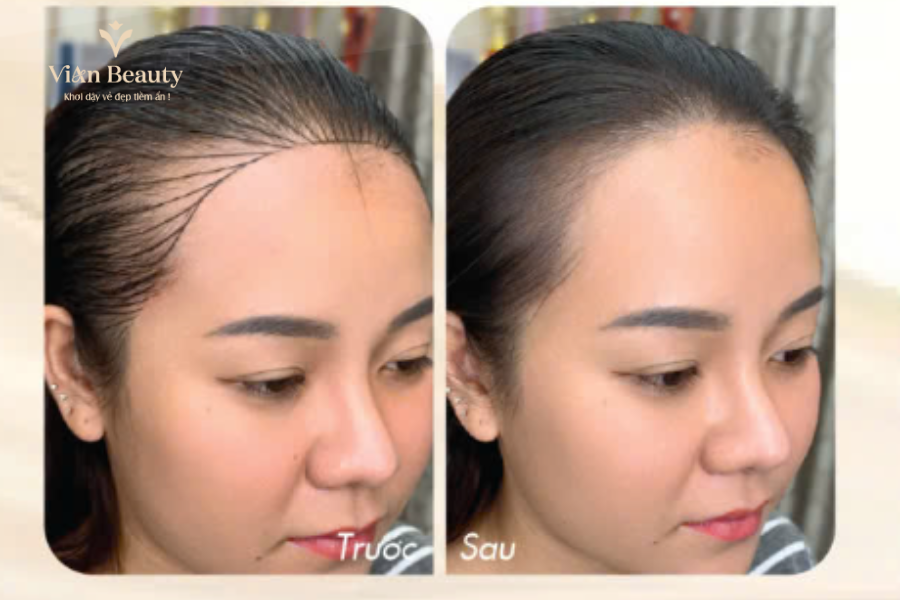 Review Dieu Khac Chan Toc