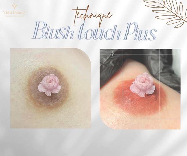 Phun Hồng Nhũ Hoa An Toàn, Mang Lại Sự Tự Nhiên