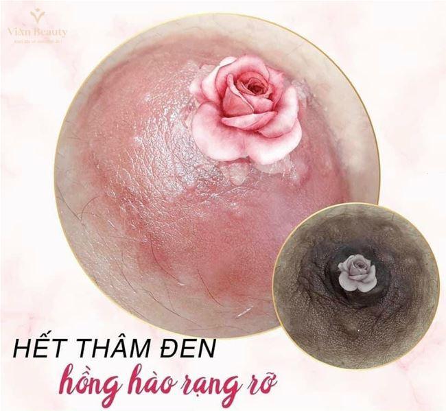 Quy Trình Phun Nhũ Hoa